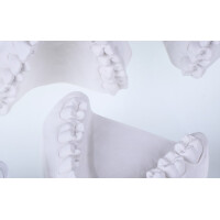 DERRock 20 kg gallery