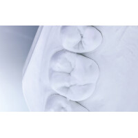 BioDurSpezial 20kg (div. Farben) gallery