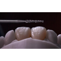 Sabi Perikymatien Fräser gallery