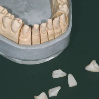 Smileline Holding Gel N.F. (5x3ml Spritze) 3