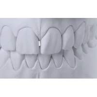 EXS-RockFlow 20kg (div. Farben) gallery