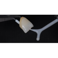 Smileline Micro-Vibes 2 3