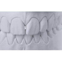 EXS-Rock 20 kg (div. Farben) gallery