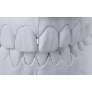 BioDurSpeed 20kg (div. Farben)