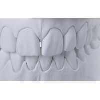 BioDurSpeed 20kg (div. Farben) gallery